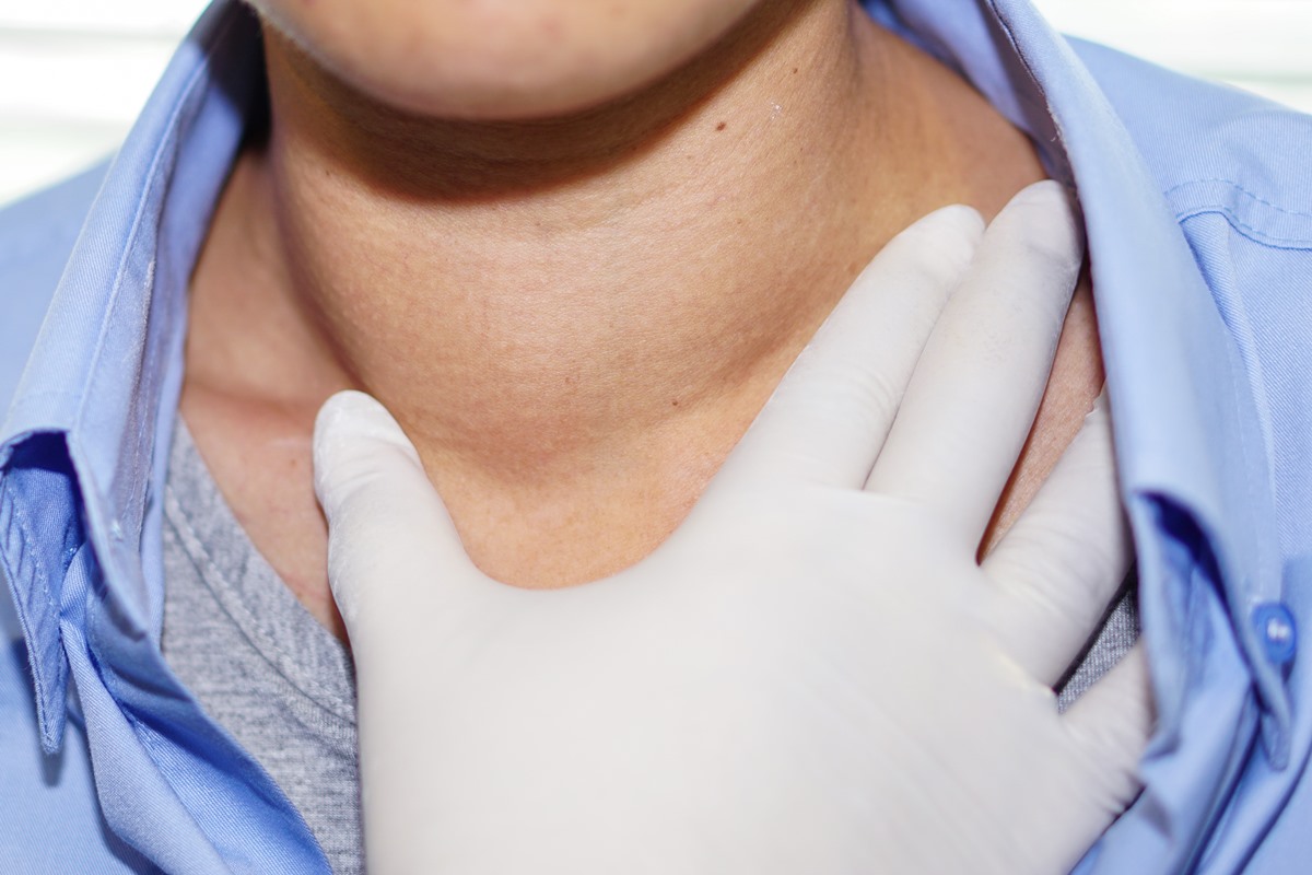 Can Thyroid Cause Lump In Throat Feeling