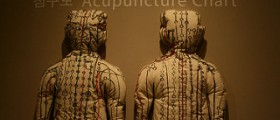 Advantages and disadvantages of acupuncture