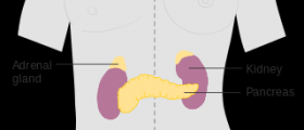 Enlarged adrenal gland