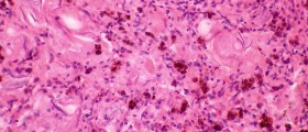 The role of amniotic fluid in pregnancy