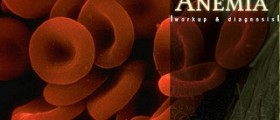 Chronic microcytic anaemia