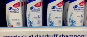 How to get rid of dandruff