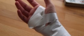 How to heal tendonitis