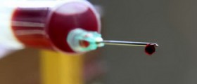 Hemophilia symptoms and treatment