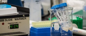 Going for sperm analysis? A short outline of the procedure