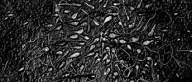 Low sperm motility and getting pregnant