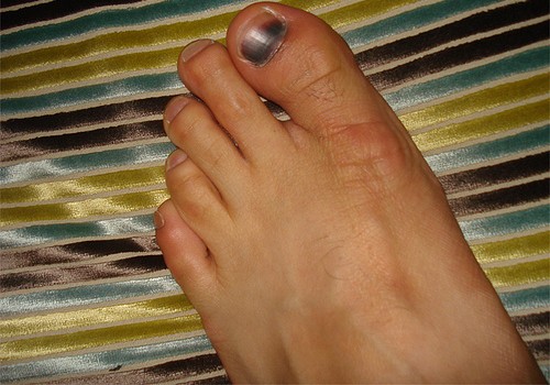 Slideshow picture