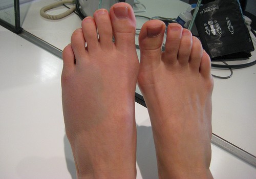 Slideshow picture