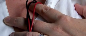 10 Surprising Effects Of Low Blood Pressure (Hypotension) On Your Health