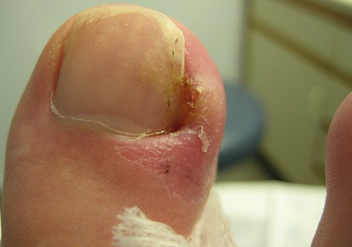 Slideshow picture
