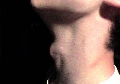 Slideshow picture