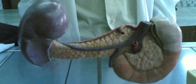 Different Experiences with Pancreatitis Diet and Life Style Changes