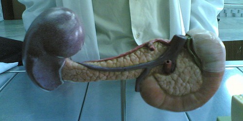 Different Experiences with Pancreatitis Diet and Life Style Changes