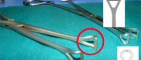 Getting your tubes tied immediately following a c-section