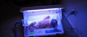 Chronic bilirubin encephalopathy