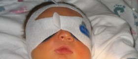 Newborn jaundice