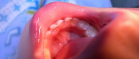 How to soothe teething pain in infants
