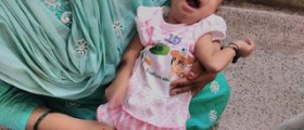 Benign congenital hypotonia
