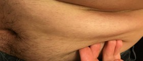 What causes belly fat