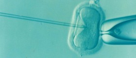 IVF babies more likely to have birth defects?