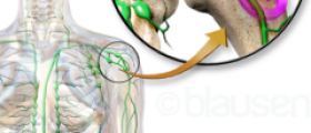 Bone cancer survival rate