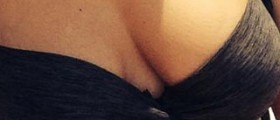 Breast fat necrosis