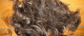 Vitamins for hair loss in women