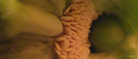 Checking your cervix to predict ovulation