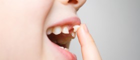 What to do if your child's tooth gets knocked out