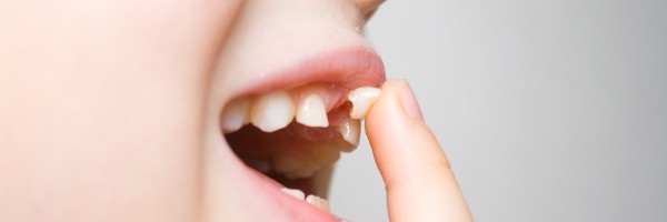What to do if your child's tooth gets knocked out