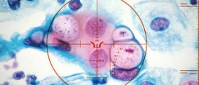 Get Tested for Chlamydia: STDs on the Rise in New Brunswick