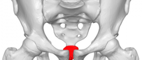 Coccyx pain relief
