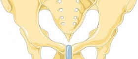 Treating Pelvic Inflammatory Disease