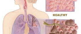 Therapy for COPD