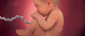 What is an amniotic fluid embolism?
