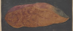 Acute yellow atrophy of the liver