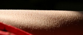 Dry skin pigmentation