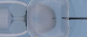 Artificial insemination process