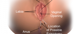 When will your episiotomy wound heal?