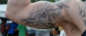 Upper arm lift