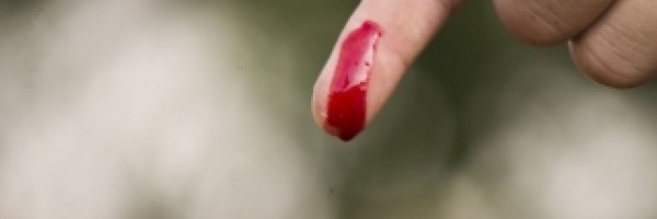 Blood disorders: hemophilia disease