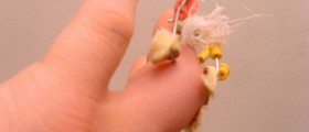 Yellow fingernails