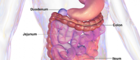 Constipation and irritable bowel syndrome