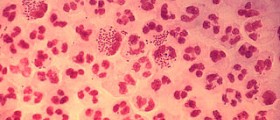 Nongonococcal urethritis review