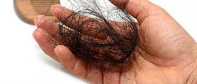 Permanent hair loss