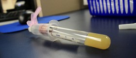 STD testing before getting pregnant