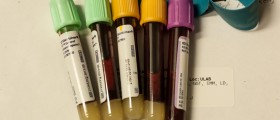 Blood volume during pregnancy