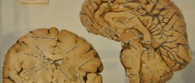 Brain foods – how eating right can save your brain