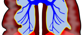 Lung disease types