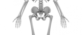 Disease where bones break easily
